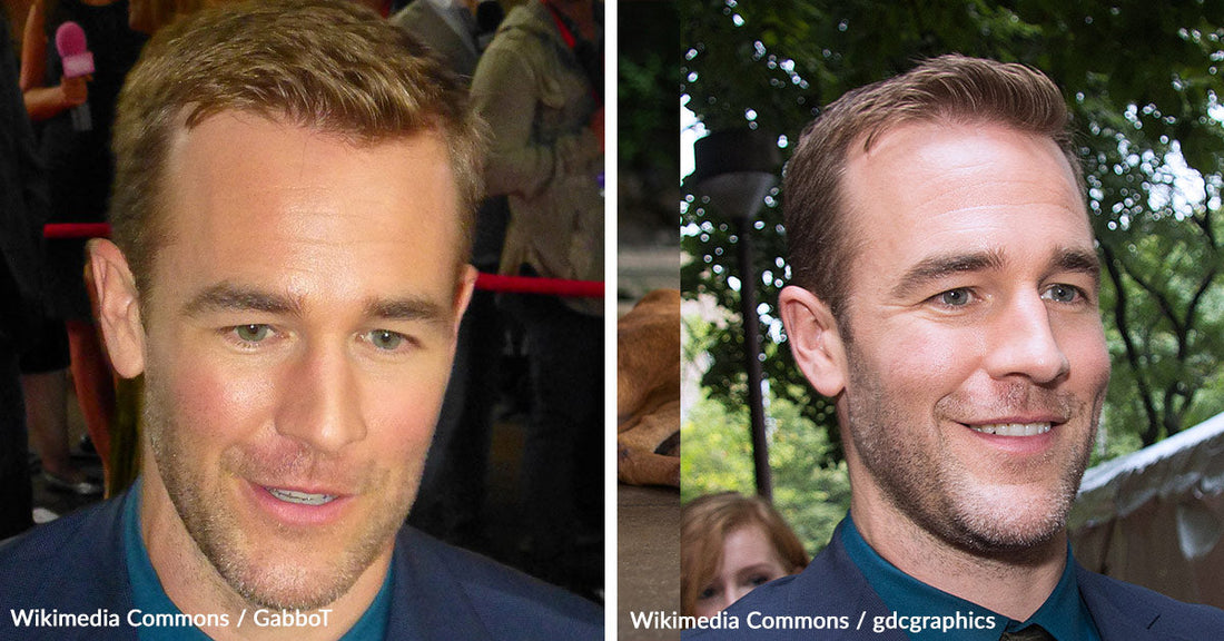 James Van Der Beek’s Journey with Stage 3 Colon Cancer Awareness