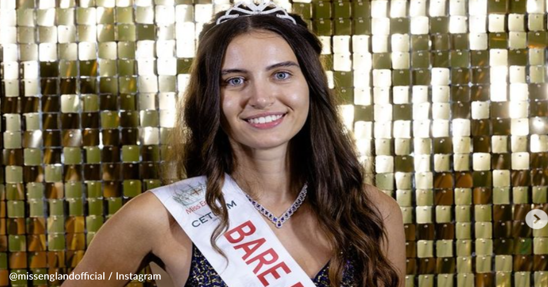 Miss England Finalist Makes History By Competing Without Makeup