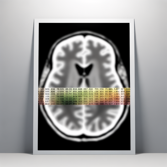 Brain scan showing early dementia biomarkers