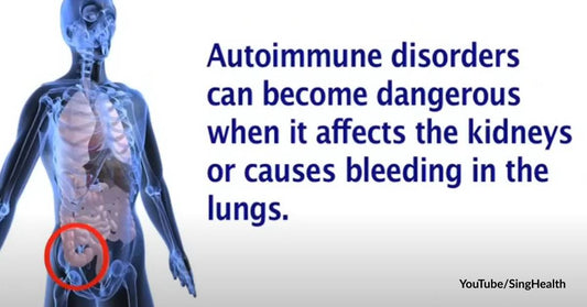 Autoimmune Diseases Are More Prevalent Than Ever! Here's What You Should Know about Them