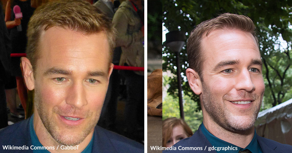 James Van Der Beek’s Journey with Stage 3 Colon Cancer Awareness | The ...