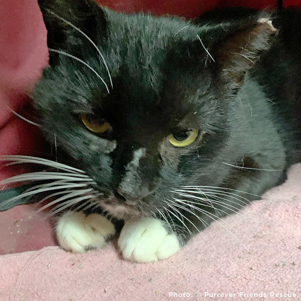 Help Checkers Overcome Severe Asthma