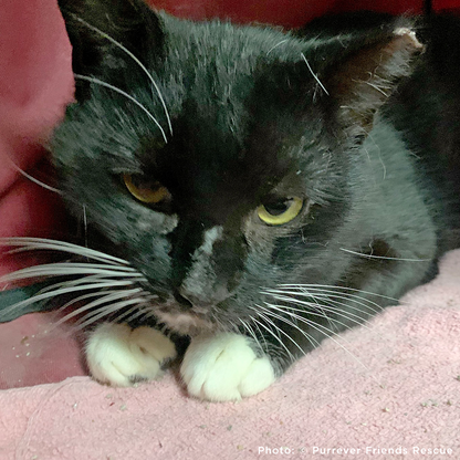 Help Checkers Overcome Severe Asthma